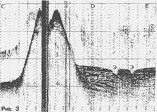 подводный вулканический массив эдельштейна
